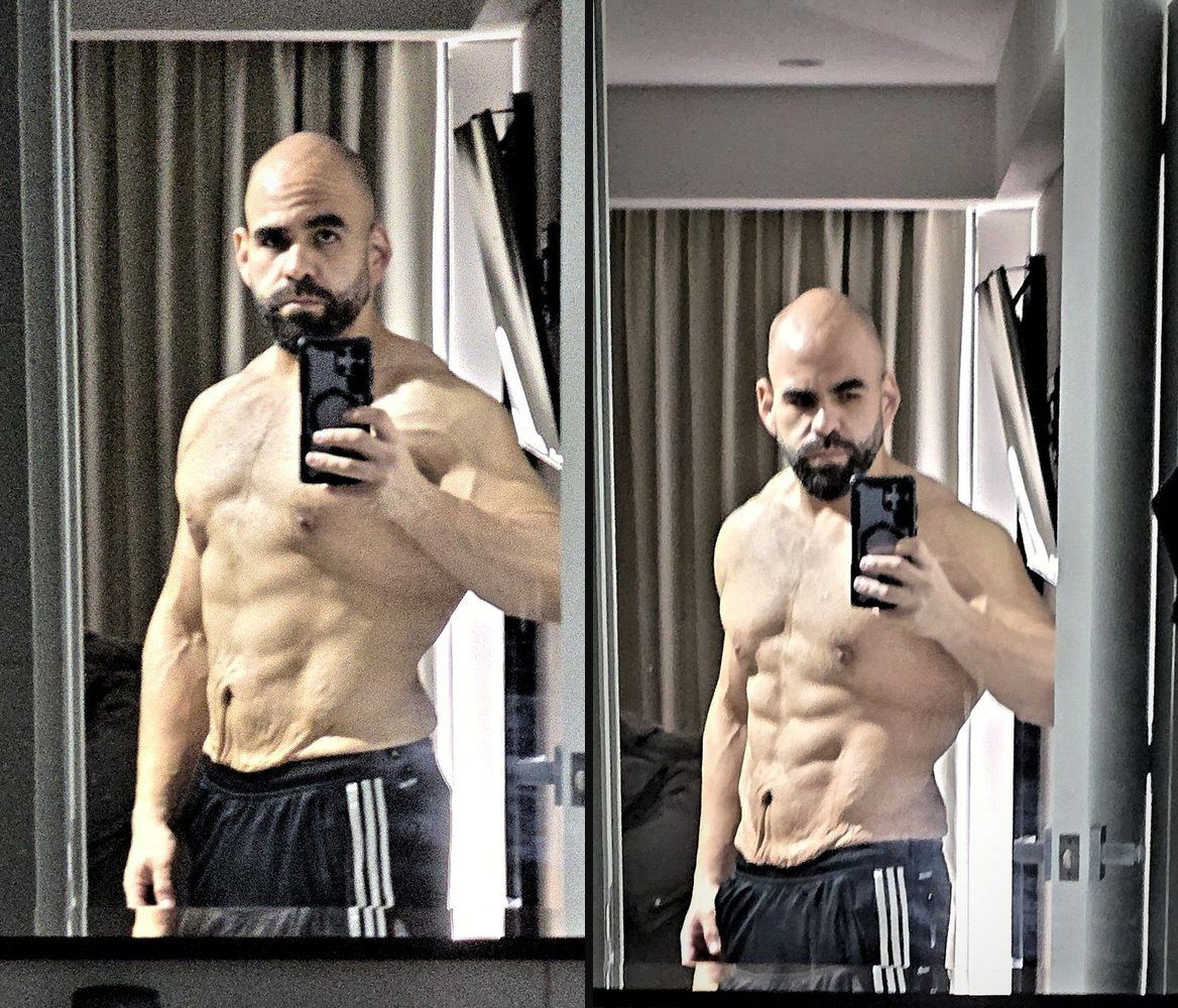 Renzo tras bajar 60 kilos, mostrando su torso con definición y piel suelta en el abdomen